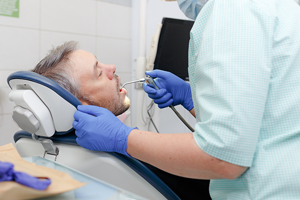 Does A Tooth Filling Last Forever?